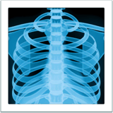 Röntgenfoto on Apple